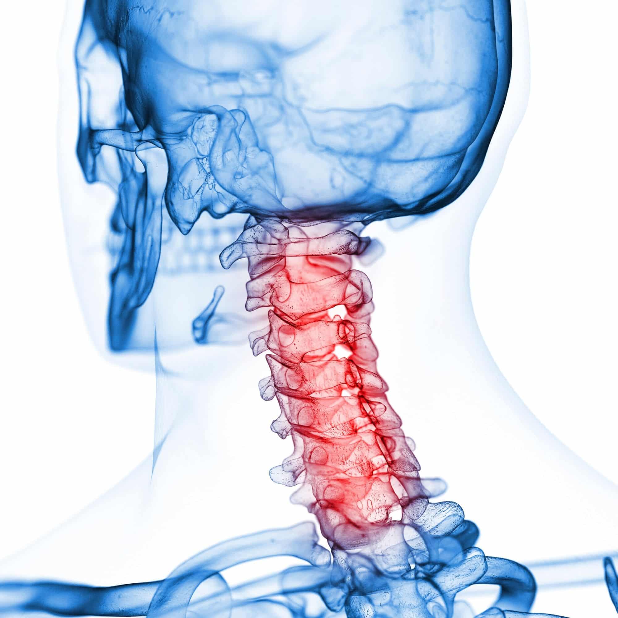 Cervical Spine