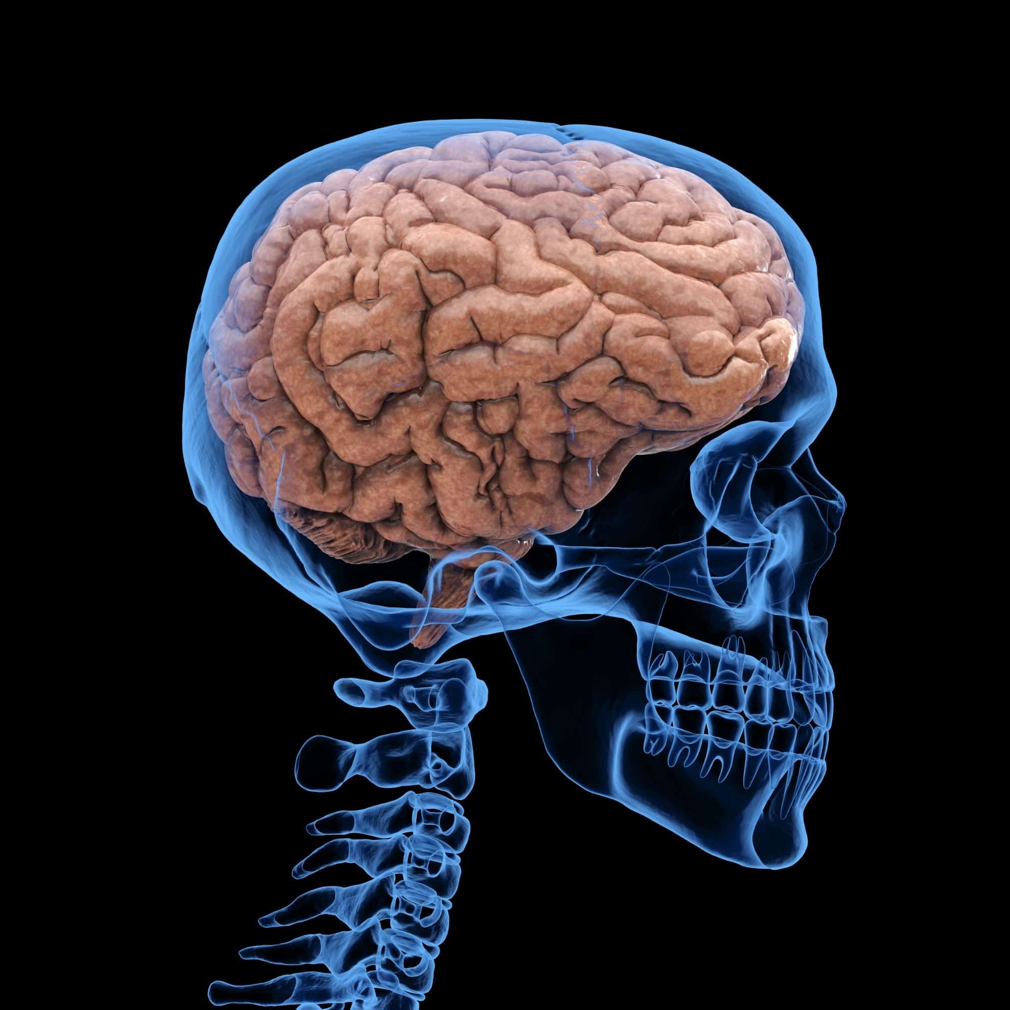 hydrocephalus in adults